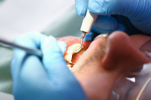 Best Emergency Dental Services for Seniors in Temple, TX