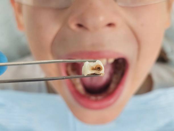 Best Emergency Dentist for Special Needs Patients in Temple, TX