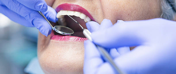 Best Emergency Dentist for Lost Fillings or Crowns in Temple, TX